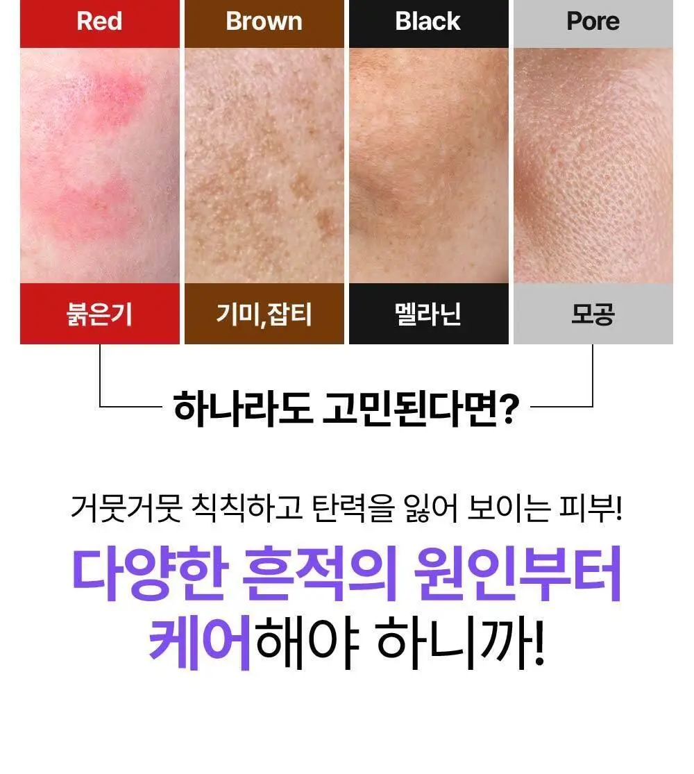 [잡티케어] 더마펌 수딩 리페어 토닝 세럼 R4 30ml 기획 (+리필 30ml) 상세페이지 14